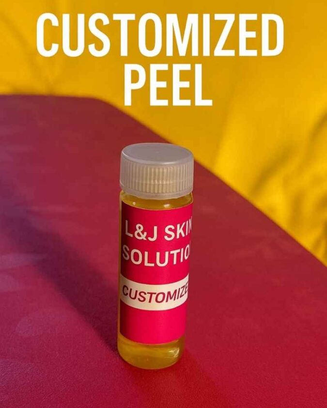 Customized Peel